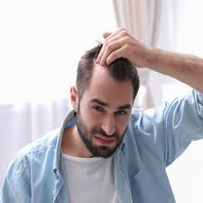 Is Dubai Good for Hair Transplants