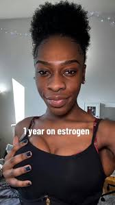 Undergoing hormone replacement therapy is ultimately your choice, but we  hope that you can also be guided