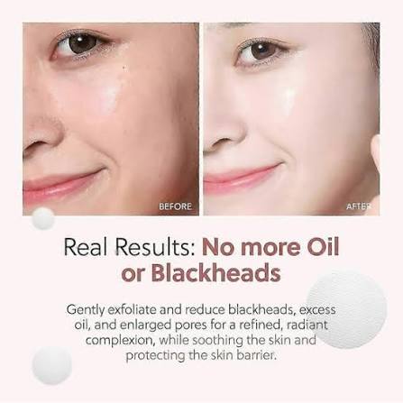 QUIA Zero Pore Pads, QUIA double-effect toner, exfoliates and reduces blackheads. | Walmart en línea