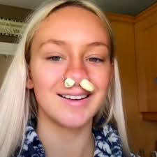 Tiktok and instagram are flooded with people sticking garlic up their noses to clear congestion, but does it really work? Tiktok Garlic Hack Criticised By Experts Video News Com Au Australia S Leading News Site