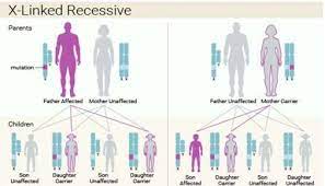 Lesch Nyhan Syndrome Physiology And Features