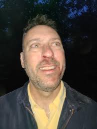 The story is much abbreviated to prevent it from being too long. On this  date, 1984, while stationed in Rimini, Italy, I was riding my bike, when I  was hit from behind