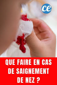 Epingle Sur Trucs Et Astuces