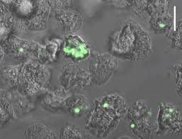 We did not find results for: Plague Bacteria May Be Hiding In Common Soil Or Water Microbes Waiting To Emerge