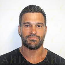 Australia's Leading Hair Transplant Doctor