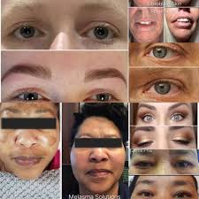 Any esthicians available Monday in GR around 3:30pm for a light exfoliation  facial with mild extractions? Would like to be in the $100-$130 range as  that's generally what I pay, my normal