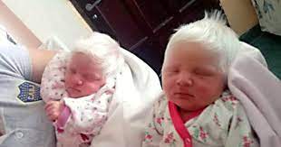 On dmc however only donte got his father genes and he was born with a black hair, vorgil however seems to be adopted. Doctors And Parents Stunned When Newborn Twins Were Born With Snow White Hair Small Joys