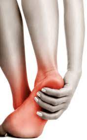 Apa obat untuk sakit telapak kaki akibat plantar fasciitis? Jangan Abaikan Telapak Kaki Sakit Blog Ruparupa