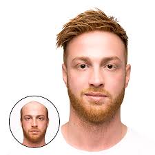 Men's Hair Replacement Systems