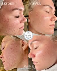 ♡SAN ANTONIO/ BOERNE AESTHETICIAN (@beautybybeckytheesti) · San Antonio, TX