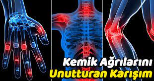 ozellikle mevsim gecislerinde yasanan kemik agrilari cok sikintili bir surectir bu durumdan da en cok dizler ve d arthritis arthritis cure arthritis treatment