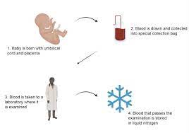 Collection of cord blood units. In The Spotlight Is Banking Cord Blood A Good Investment Eurostemcell
