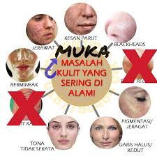 = profix = vitamin muka yg dpt membantu merawat muka berlubang. Masalah Kulit Muka Sihatcantik24jam