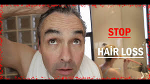 Hair growth time lapse 1 month. Two Years Time Lapse Hair Growth Video Dailymotion
