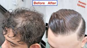 Being a part of the hair structure itself, keratin can be increased or added through treatment or diet in order to increase hair volume. Hair Keratin Treatment For Thin Hair Curly To Straight Hair Hair Straightening Men Hairstyles Youtube