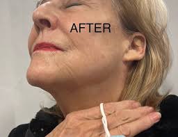 BAIRE-Hair Removal, Lashes,Brows,Facials