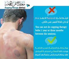 9 hijama الحجامة cupping ideas hijama cupping therapy beliefs