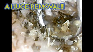 The next step on how to remove sebum from the scalp is to use a brush that is made for this purpose. Is Your Curly Hair Routine Hurting Your Scalp Naturallycurly Com