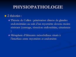 Les cryptes sont détruites et réséquées et les nodules d'adénomyose sont ôtées. Diagnostic De L Adenomyose Ppt Telecharger