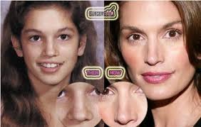 Pin On Celebrity Rhinoplasty Celebrity Nose Job