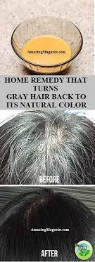 Pin On Hairloss Solution