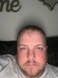 Cutoff Wheel Explosion and Safety Precautions