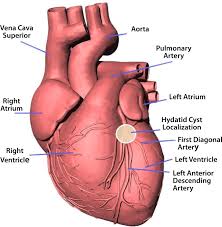 Maybe you would like to learn more about one of these? Scielo Brasil Intracoronary Hydatid Cyst Resulted In Coronary Artery Disease In A Young Patient Intracoronary Hydatid Cyst Resulted In Coronary Artery Disease In A Young Patient