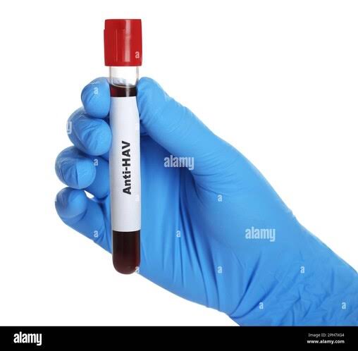 ANTI HCV product image