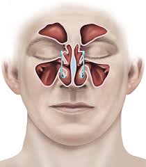 Learn how they are diagnosed and treated. Endoscopic Sinus Surgery Healthdirect
