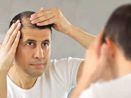 Some men first notice thinning towards the back of the head (crown). Hair Transplant Indian Men Tackling Baldness As Early As In Their 20s The Economic Times