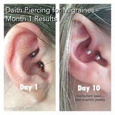 The Ear Piercing For Migraines Results After 31 Days Earpeircingsideas Peircingsear Ear Piercing For Migraines Migraine Piercing Daith Piercing Migraine