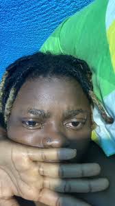 As a welder, never let arc eye affect you. The worst part is when you're a  beginner trust me, if welding isn't your true passion or you don't have the  determination, arc