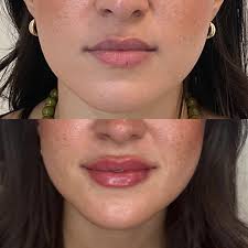 Aestheics nurse practitioner