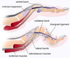 Image result for Elson Extensor Tendon Test