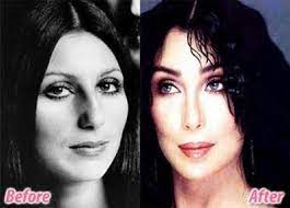 Find out which plastic surgery procedures are performed most often. Fresh Pics Celebrities Before And After Plastic Surgery Cher Plastic Surgery Celebrity Plastic Surgery Celebrity Surgery