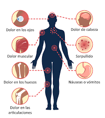 Sintomas Y Tratamiento Dengue Cdc