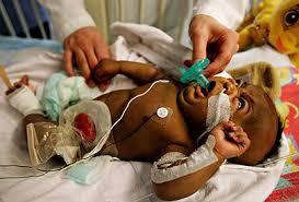 Group For Improvement Of Intestinal Function And Treatment Program Gift Une Place De Choix