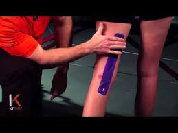 Pin By Kt Tape On Kt Tape Applications Kt Tape Knee Kinesiology Taping Hamstring Tendonitis