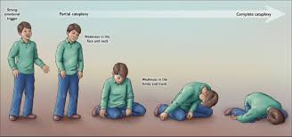 Image result for Narcolepsy