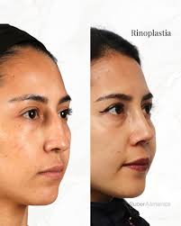 Dr. Ruber Almanza,...