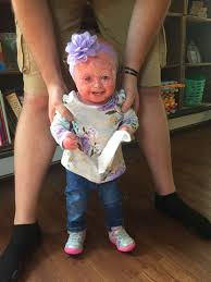 Baby girl born with rare condition that means she sheds her skin 10 TIMES  faster than normal