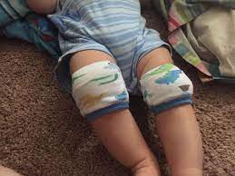 Diy Baby Knee Pads