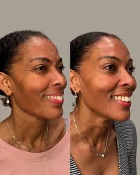 Rachel Codd DNP, AGACNP-BC (@rachelcodd.dnp) • Instagram photos and videos