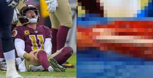 Alex smith is retiring from the nfl after making an improbable comeback from a broken leg. Alex Smith S Bone Was Completely Exposed A Week After His Injury And 8 Surgeries Video Pic Total Pro Sports