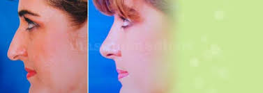 Dr. Jose David Villfañe