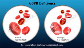 In addition to the apa citation generator, scribbr provides many more tools and resources that help millions of students and academics every month. G6pd Deficiency Causes Triggers Signs Symptoms Treatment Diagnosis