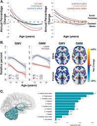 Sex Differences In The Developing Brain Insights From