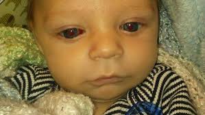 Who failed baby Benjamin?