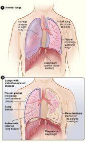 Pin On Cancer