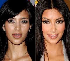 Celebrity Nose Jobs Before And After Kardashian Plastic Surgery Celebrity Plastic Surgery Kim Kardashian Before